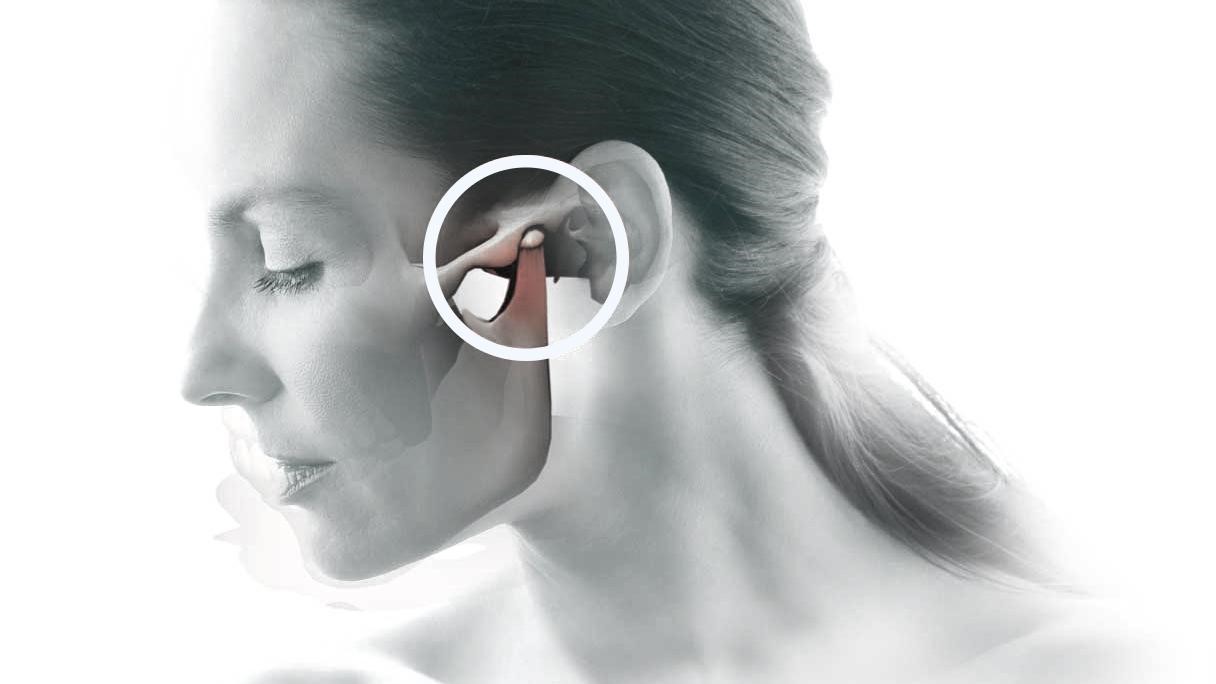 DOR OROFACIAL E DISTURBIOS ATM, CIRURGIA OROFACIAL RECREIO