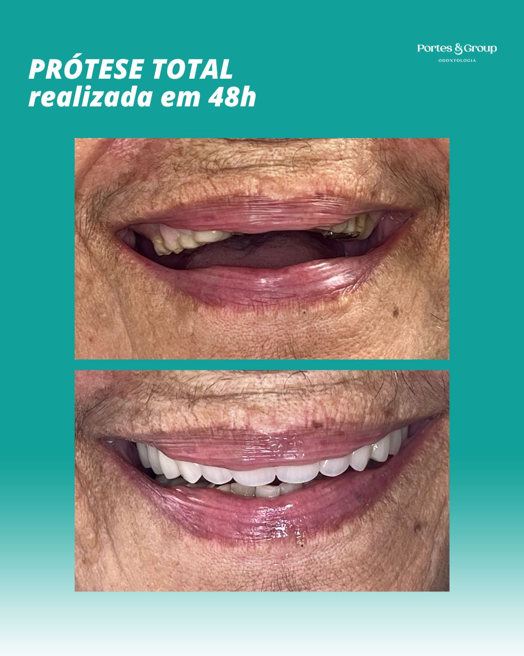 PORTESES DENTÁRIAS RECREIO